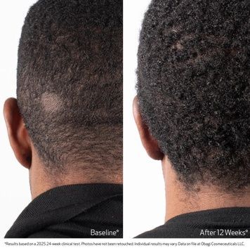 , 60мл  фото